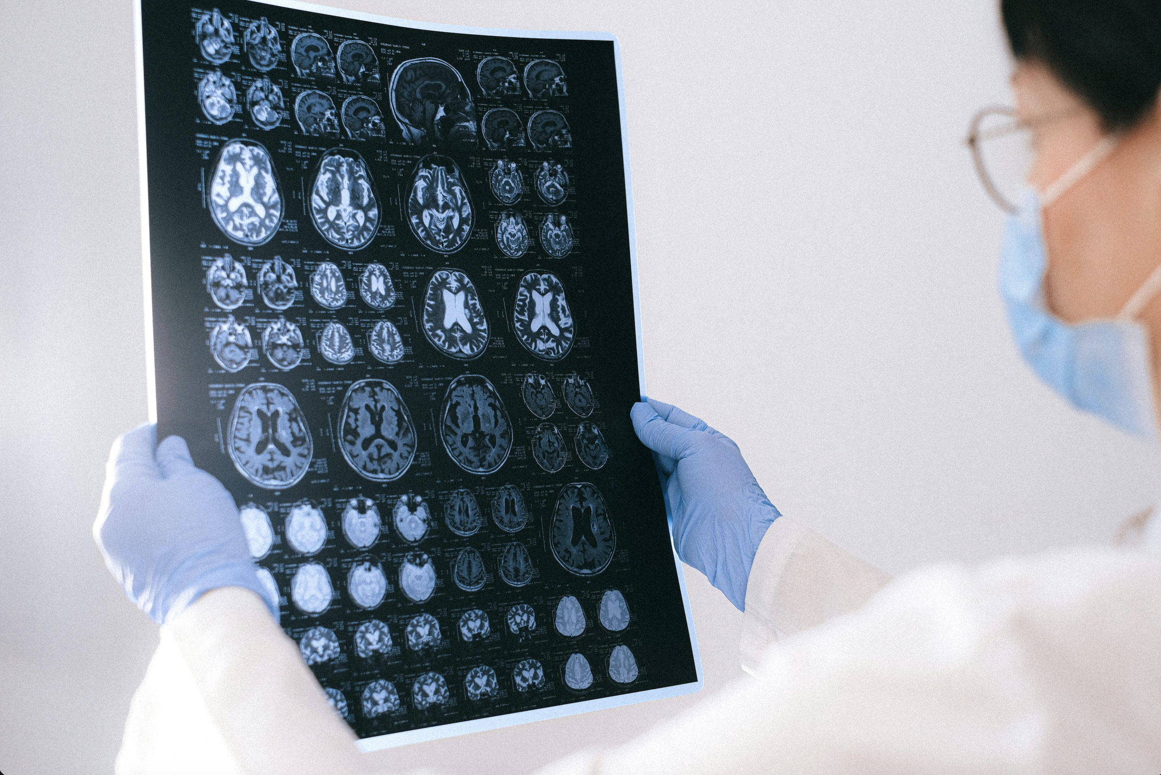 Des chercheurs français développent un traitement contre Parkinson